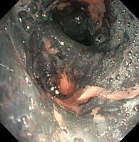 Soot deposition