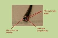 Video bronchoscope, cross section (annotations)